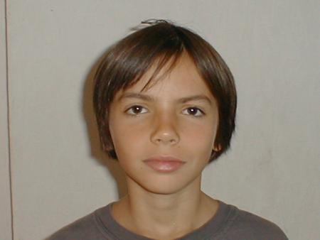 face de hamster